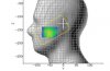 US Gov. AC recommends FCC mobile radiation reassesment