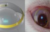 Contact lenses of the future: read emails and play games